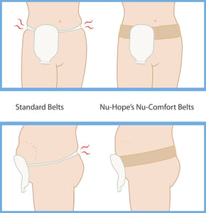 Nu-Hope Nu-Support™ Elastic Ostomy Belt, with Plastic Buckle, Hook